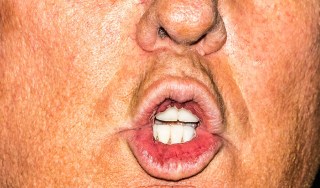 Trump's Mouth